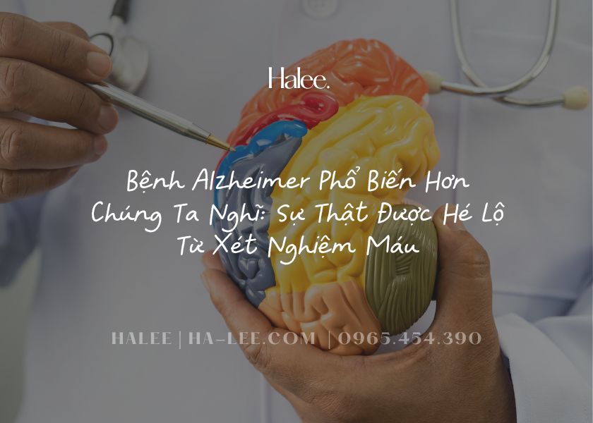 Bệnh Alzheimer Phổ Biến Hơn Chúng Ta Nghĩ Sự Thật Được Hé Lộ Từ Xét Nghiệm Máu